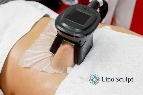 Does Fat Freezing at Home Work? DIY Devices vs Professional Cryolipolysis 1 How is professional cryolipolysis different Tilbury?