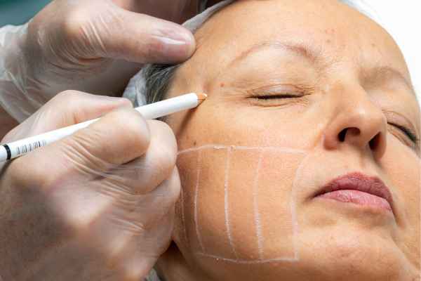 CryoPen: 5 Skin Concerns It May Be Used to Treat 4 What should you ask before having CryoPen treatment Tilbury?