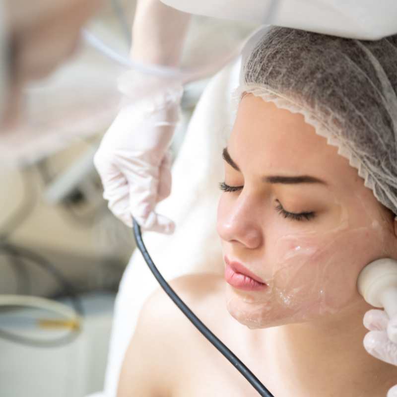 Why Do People Choose HIFU for a Non-Surgical Facelift? 5 What are the risks Tilbury?