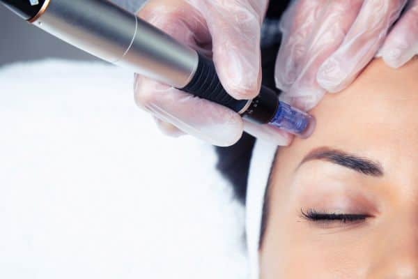 Explaining Total Skin Tightening Treatment and What to Expect 2 What Skin Concerns Can Total Skin Tightening Treatment Help With Tilbury?